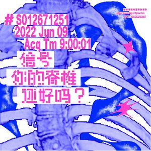 《信号—你的脊椎还好吗？》